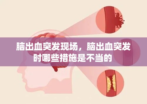 腦出血突發(fā)現(xiàn)場，腦出血突發(fā)時(shí)哪些措施是不當(dāng)?shù)?