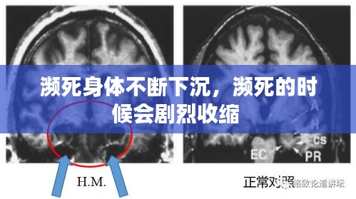 瀕死身體不斷下沉，瀕死的時候會劇烈收縮 