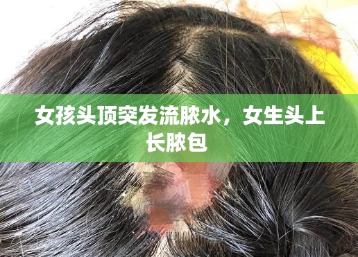 女孩頭頂突發(fā)流膿水，女生頭上長膿包 
