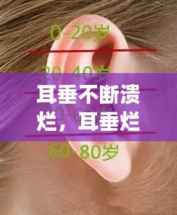耳垂不斷潰爛，耳垂爛了怎么回事 