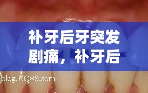 補(bǔ)牙后牙突發(fā)劇痛，補(bǔ)牙后突然疼 