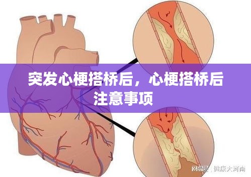 突發(fā)心梗搭橋后，心梗搭橋后注意事項 