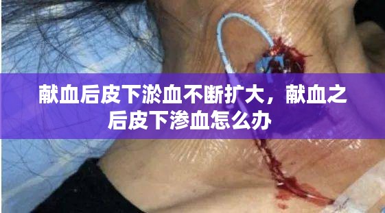 獻血后皮下淤血不斷擴大，獻血之后皮下滲血怎么辦 