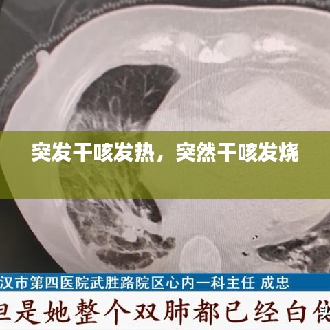 突發(fā)干咳發(fā)熱，突然干咳發(fā)燒 