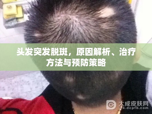 頭發(fā)突發(fā)脫斑，原因解析、治療方法與預防策略